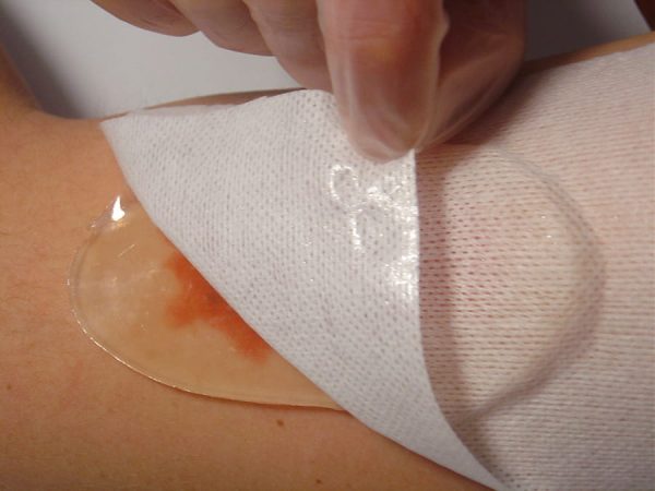 Aqua-Gel – tai tvarstis sunkiai gyjancioms zaizdoms. militra Aqua Gel – tai tvarstis sunkiai gyjancioms zaizdoms. militra