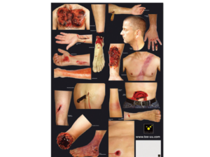 INJURY SIMULATION PATTERNS INJURY SIMULATION PATTERNS