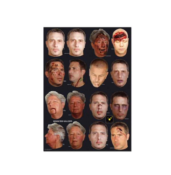 INJURY SIMULATION2025-03-19 213026 INJURY SIMULATION2025 03 19