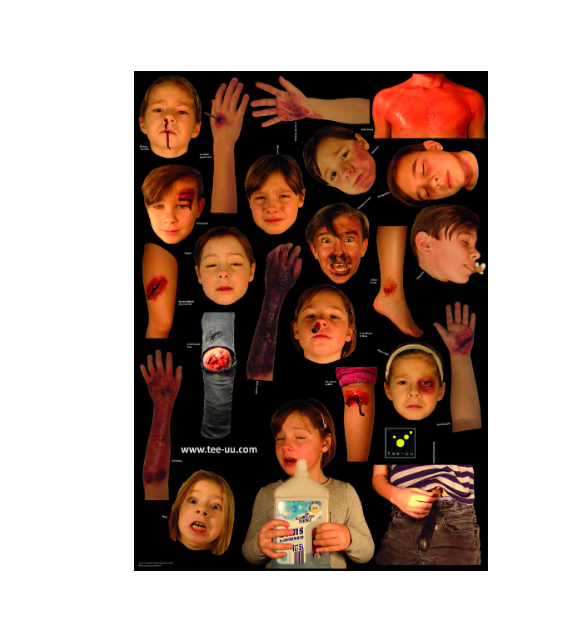 INJURY SIMULATION PATTERNS JUNIOR INJURY SIMULATION PATTERNS JUNIOR